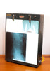 Rare 1950s X-Ray Light Box by Picker, w/ Matching X-Ray Timer